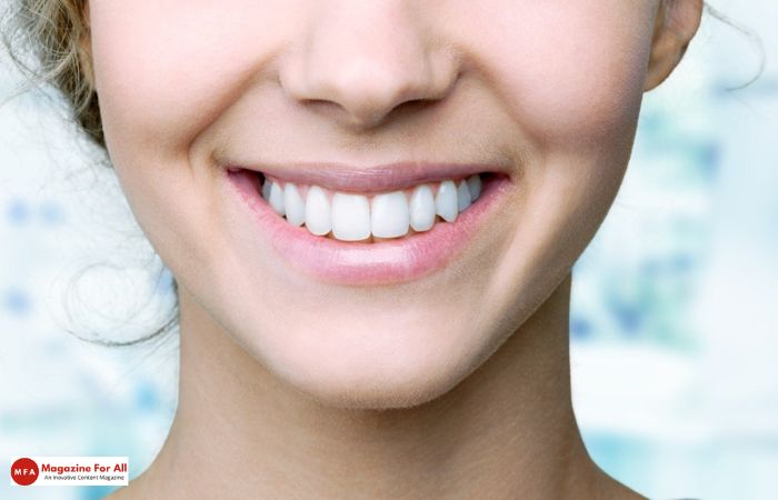 Benefits of Perfect Straight Teeth